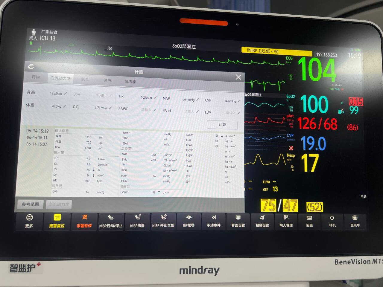 �S���������t(y��)ԺICU�F(tu��n)�(du��)�ɹ��_չPICCO�O(ji��n)�y(c��)���g(sh��)