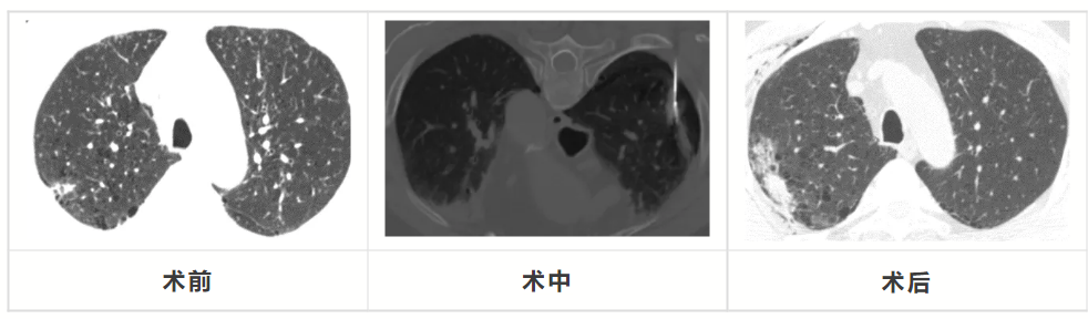 �S���������������t(y��)Ժ�ɹ��_(k��i)չ��(j��ng)Ƥ�β��[��΢�������g(sh��)