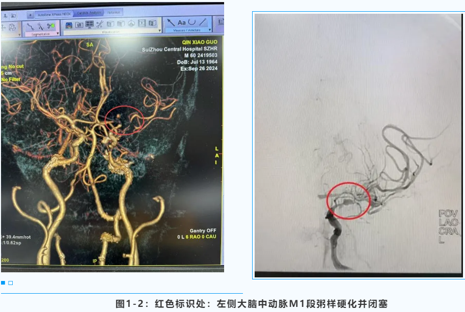 ͻ�l(f��)�X������������һ���� �����������^(q��)�Ѕf(xi��)ͬʩ����