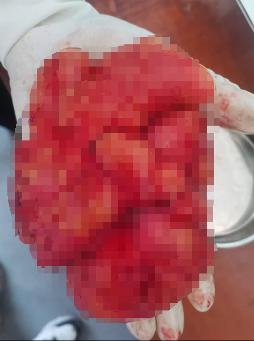 �����^(q��)����(zh��n)�l(w��i)��Ժ��Ƴɹ��_չ֬�����г��g(sh��)